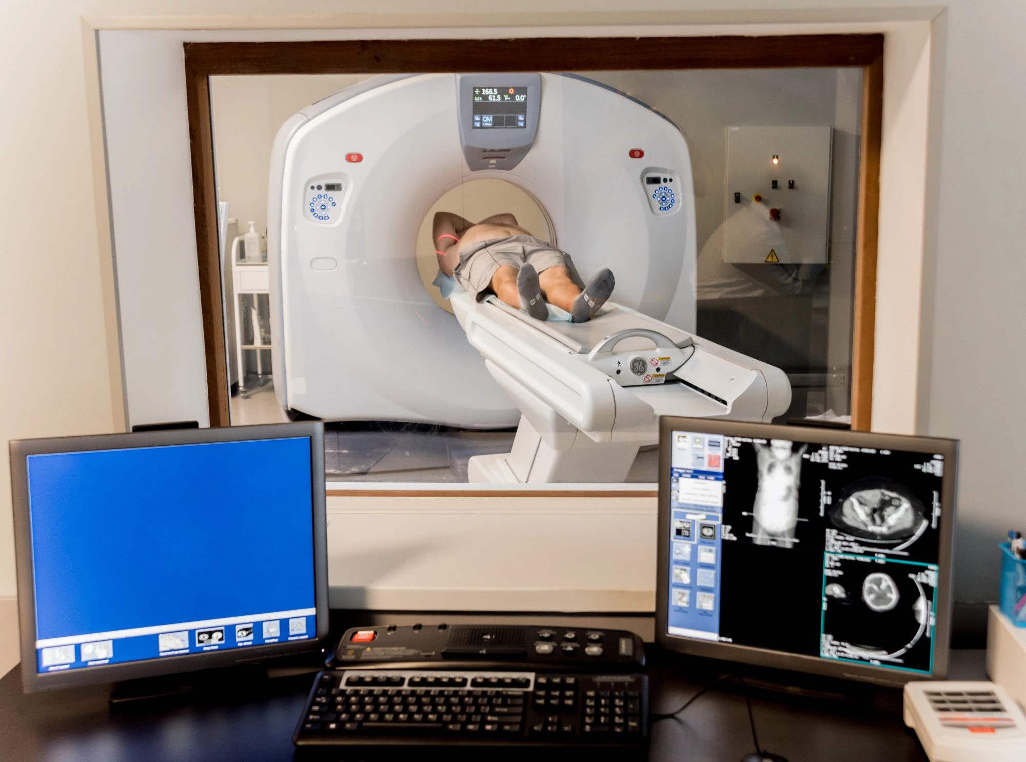 CT (Computed Tomography)